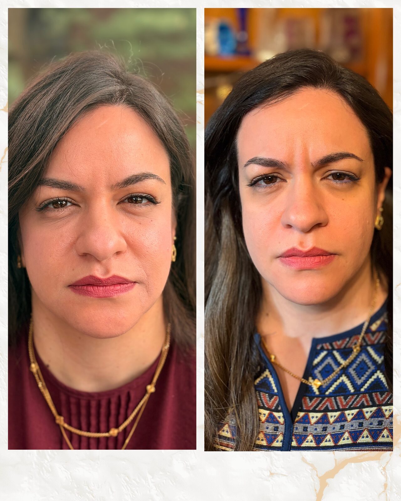 Mrs. R — before and after, expression